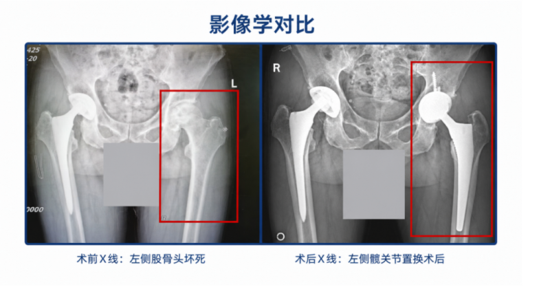 成都育扬：骨科微创治疗领域的高效桥梁