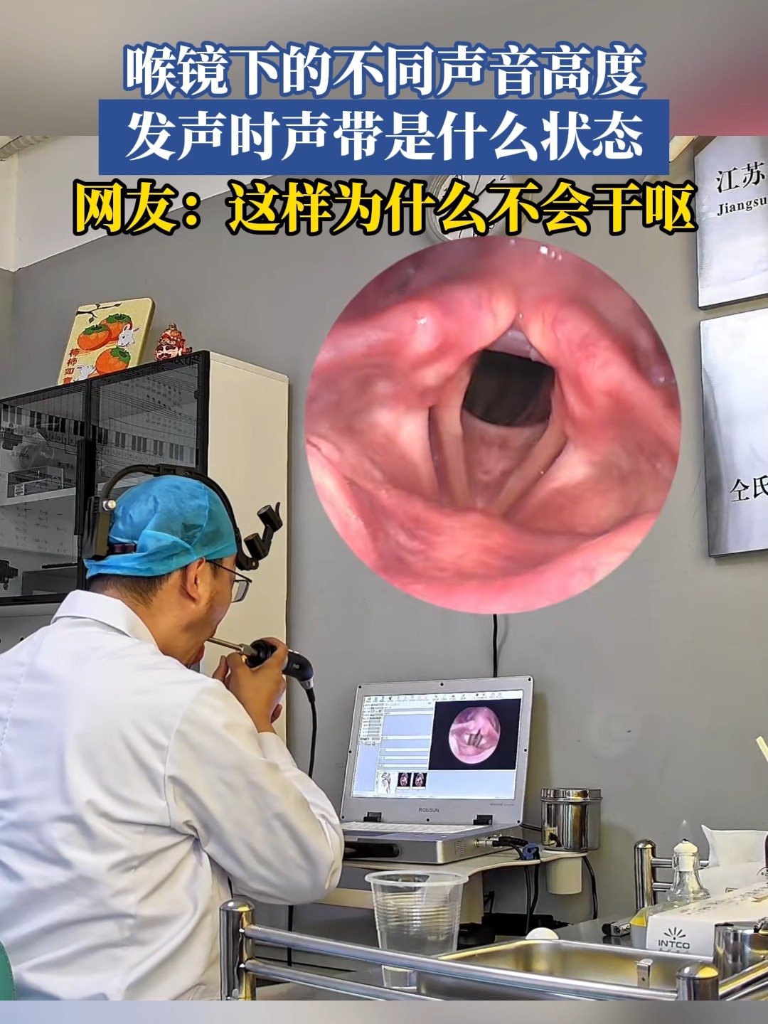 电子烟暴露对外科声带损伤后伤口愈合的影响。