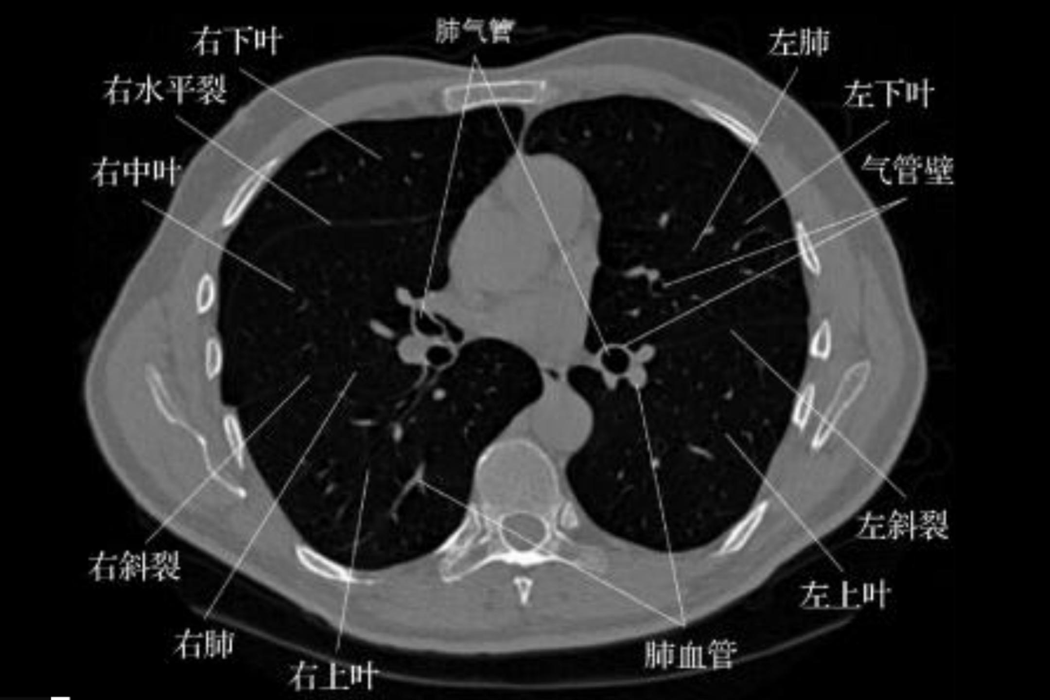 基于有氧肺部疾病(如慢性阻塞性肺疾病(COPD)和肺部肿块(肺结节))和肺部肿块(肺结节))的分类分析,机器学习集成免疫