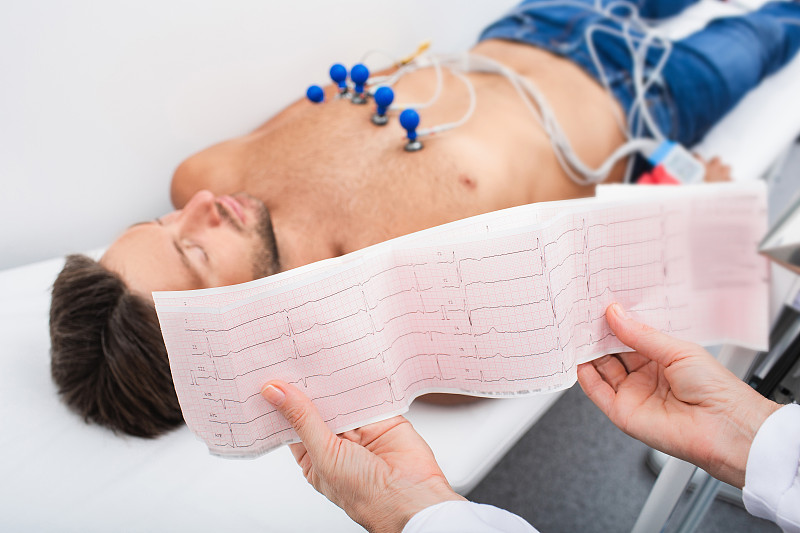 ST- elevation myocardial infarction(ST-elevation myocardial