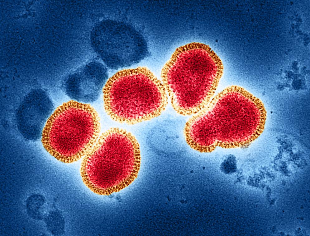 甲型H3N2亚型流感病毒仍占流行优势