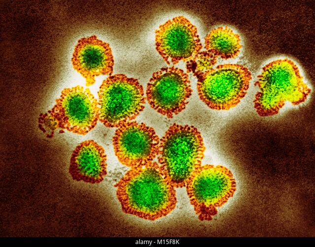 인플루엔자 A H3N2 부종 바이러스는 여전히
