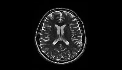 У ADHD может быть удивительное творческо