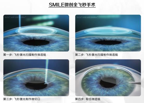 SMILE toàn giây, công nghệ và thẩm mỹ làm sáng tỏ cuộc sống
